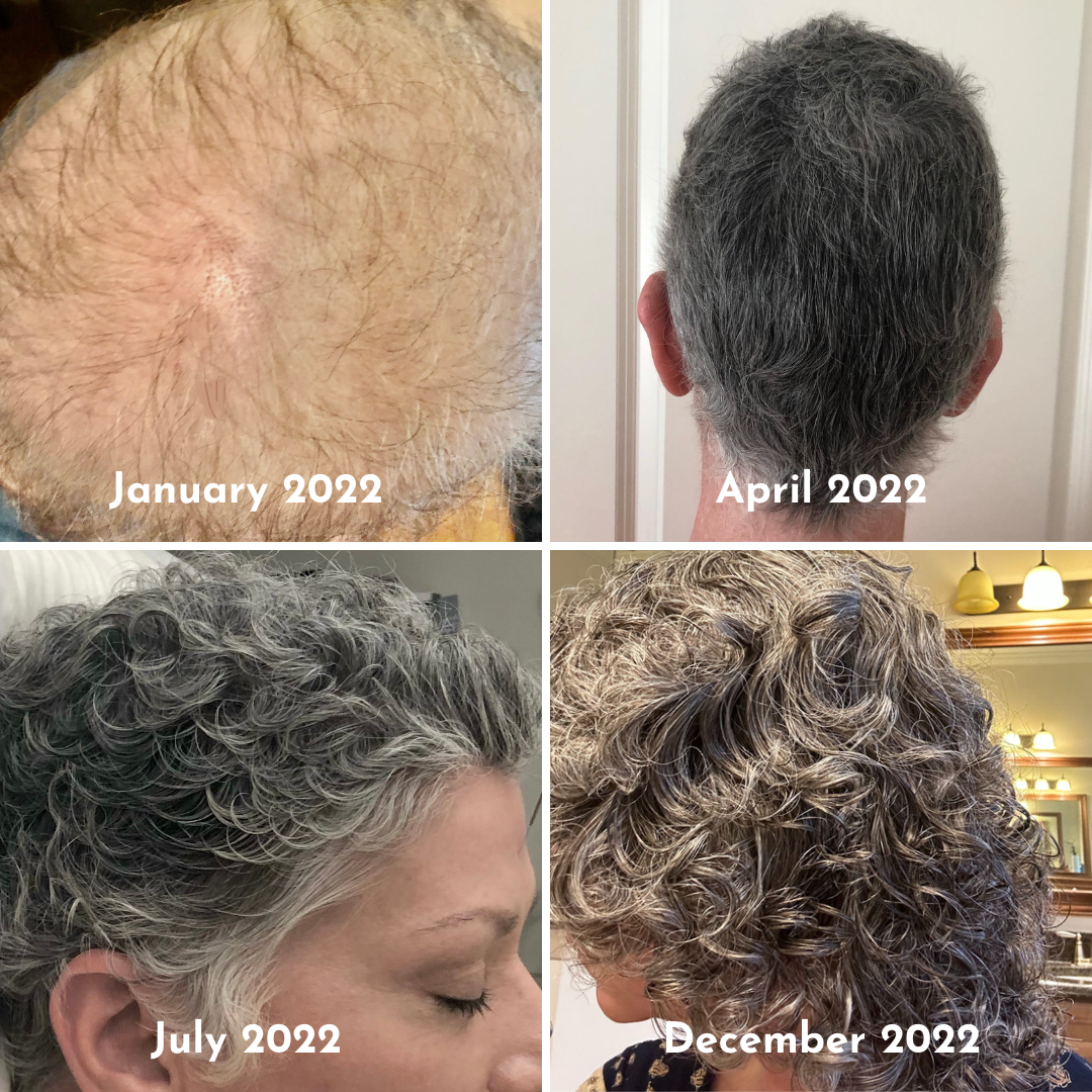 natural hair growth before and after